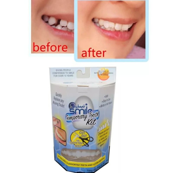 Whitening Gigi Palsu Instan Tempel Temporary Tooth Kit