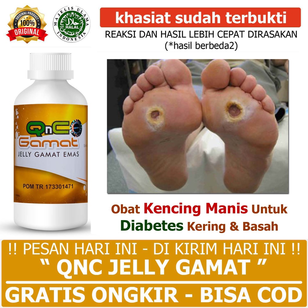 Jual Obat Kencing Manis Untuk Diabetes Melitus Luka Kering Basah Di