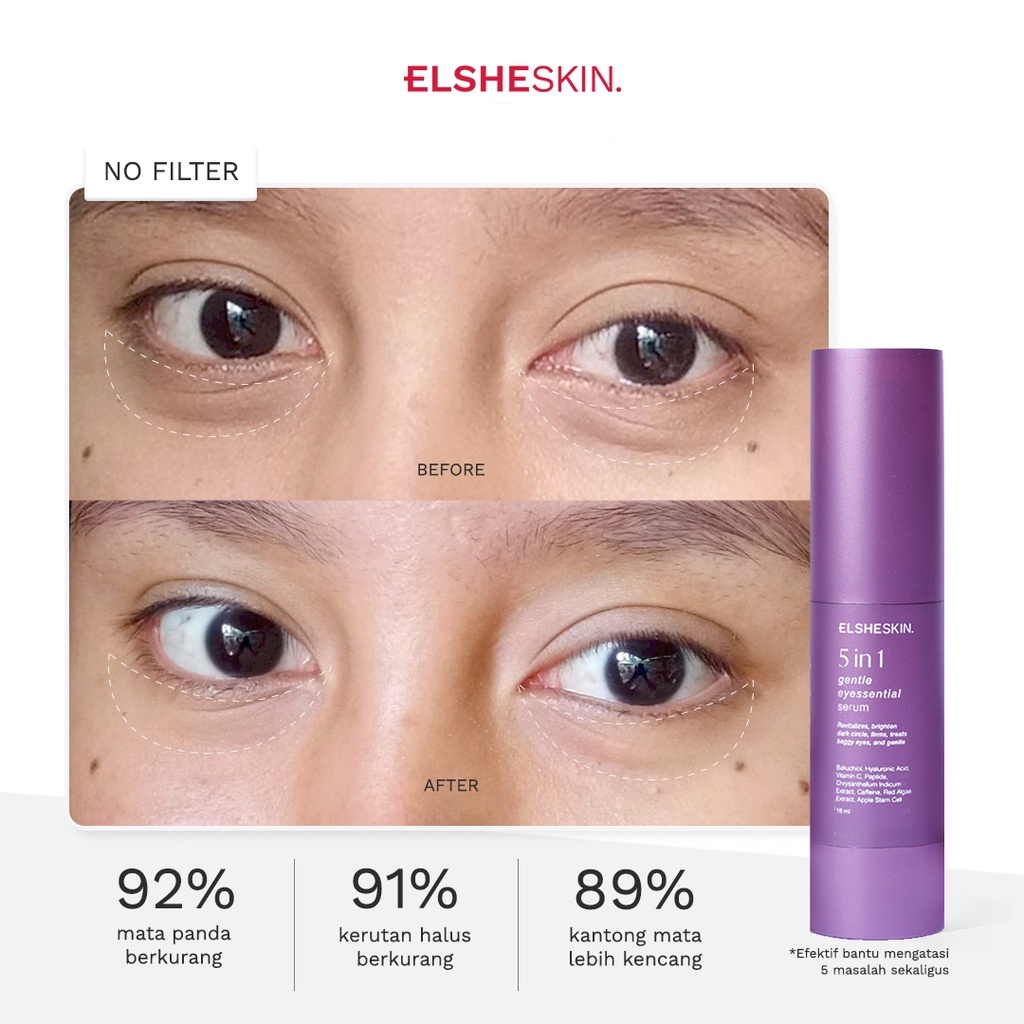 ★ BB ★  ELSHESKIN 5 in 1 Gentle Eyessential Serum 18ml Bakuchiol | 7 hari Kencangkan Kulit Mata - Eye Serum Anti Aging Mencerahkan