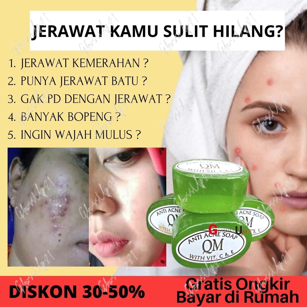 SABUN KHUSUS WAJAH DAN TUBUH BERJERAWAT QM FACIAL SOAP FOR ACNE SKIN BPOM - SABUN QM ANTI ACNE