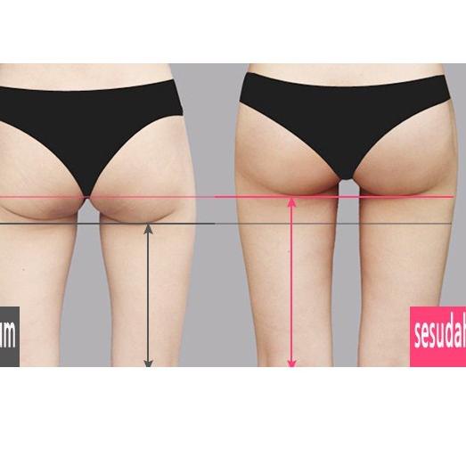 FREE ONGKIRTERAMPUH ORI Pembesar Pantat Bokong Wanita Xtrass Oil|RA6