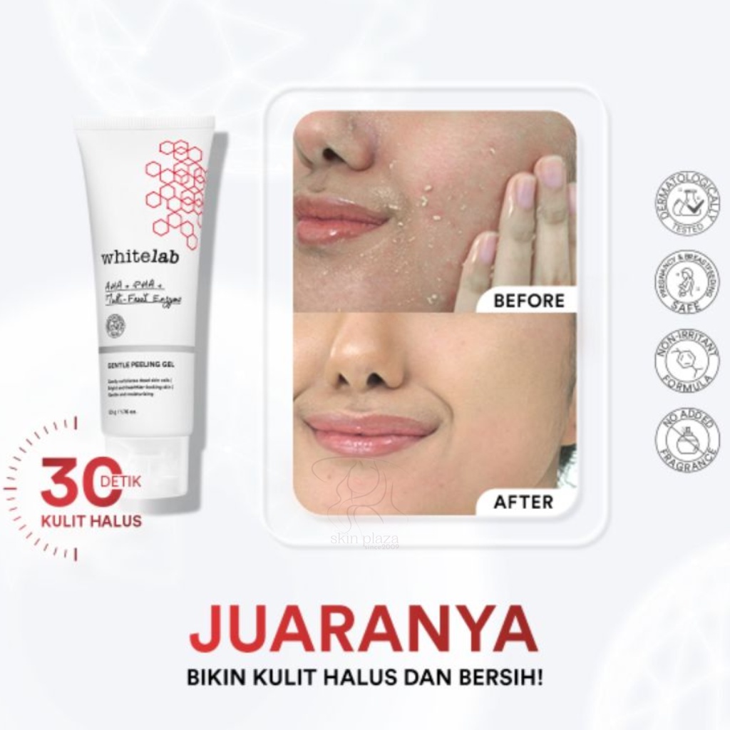 Whitelab Gentle Peeling Gel Untuk Sel Kulit Mati 50gr