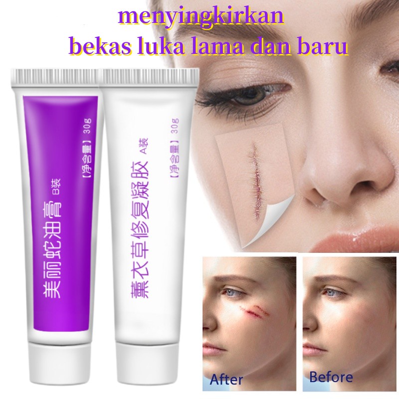 Jual Krim Bekas Luka Penghilang Bekas Luka Ekstrak Tumbuhan Salep Luka