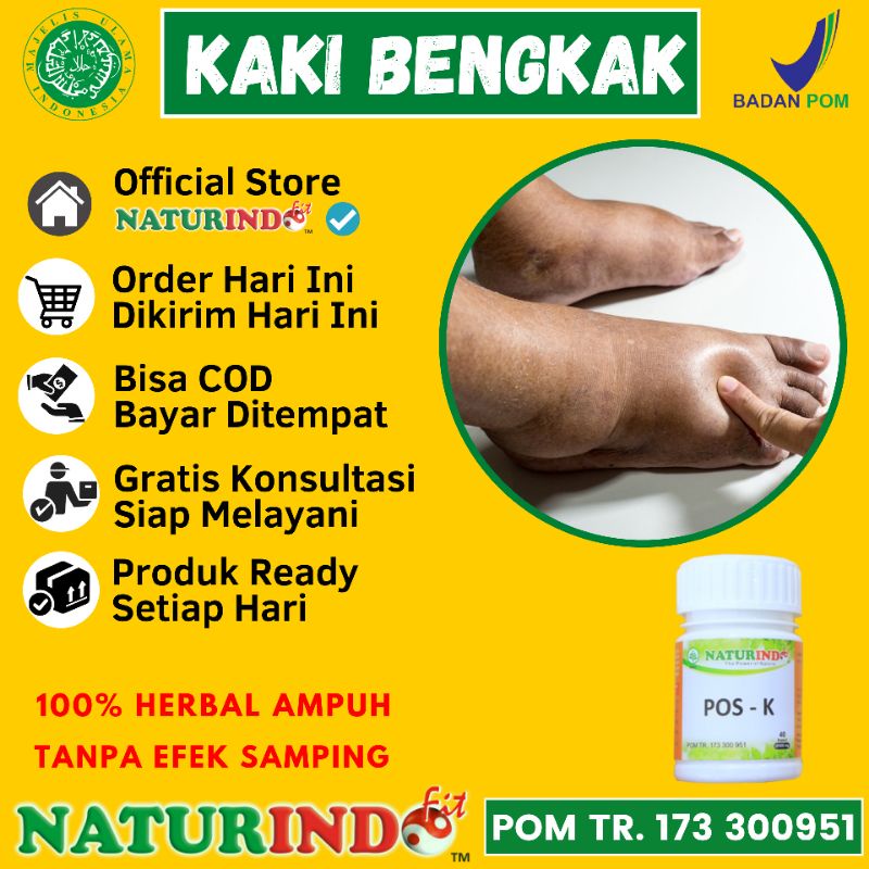 Obat Kaki Bengkak Karena Asam Urat Jantung Gula Diabetes