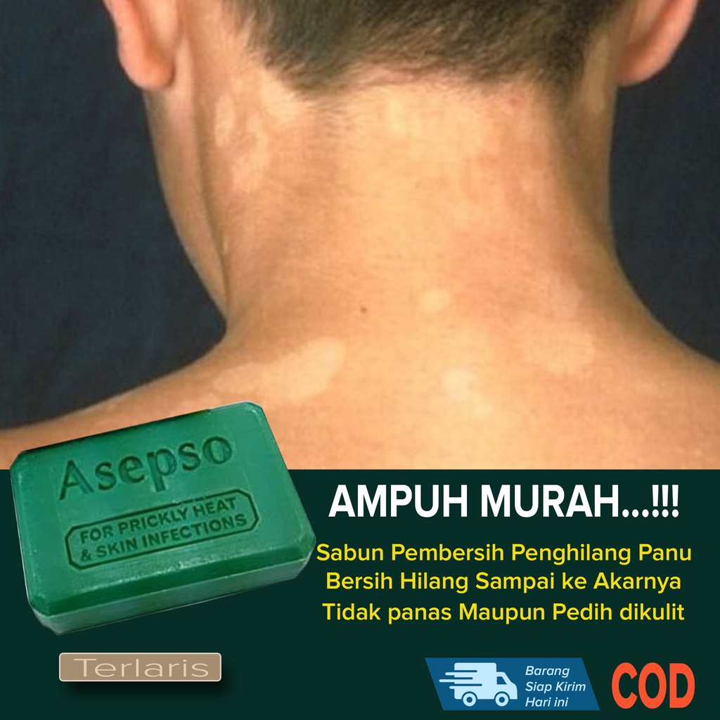 BEST SELLER Sabun Pembersih Panu AMPUH MURAH Sabun Penghilang Pembersih Panu Kuman Kadas Kudis Range