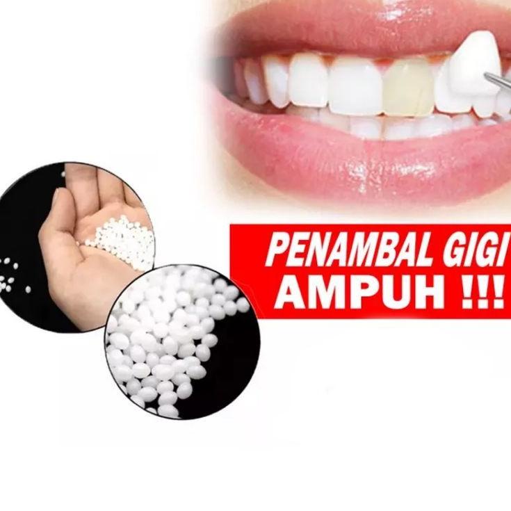 [158] Penambal Gigi Berlubang Instan Dengan Temptooth / Gigi Palsu / Tambal Gigi Berlubang / Penamba