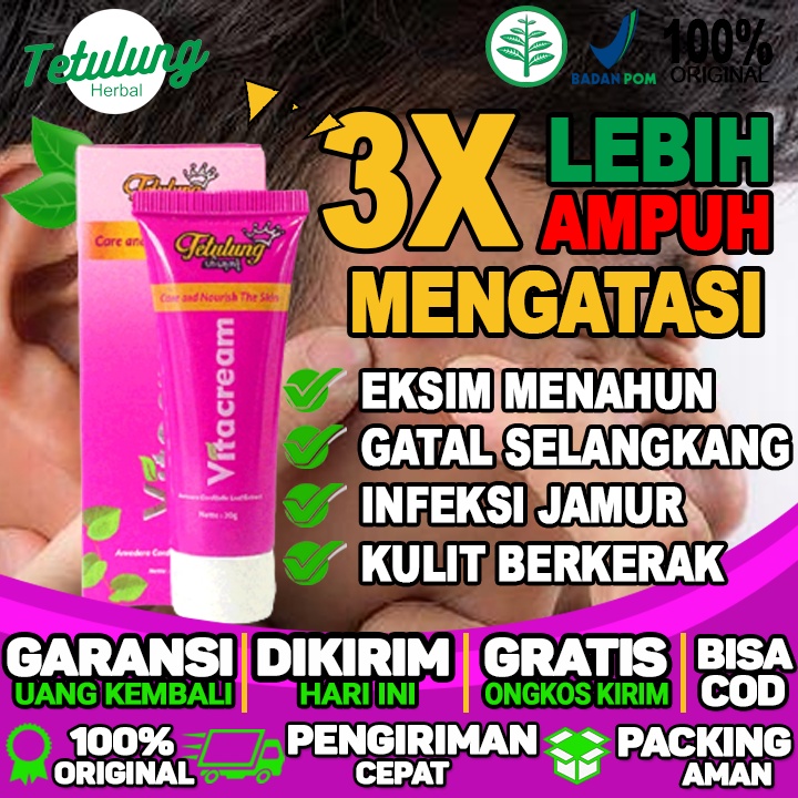 obat eksim basah dan eksim kering obat herbal eksim dijamin ampuh