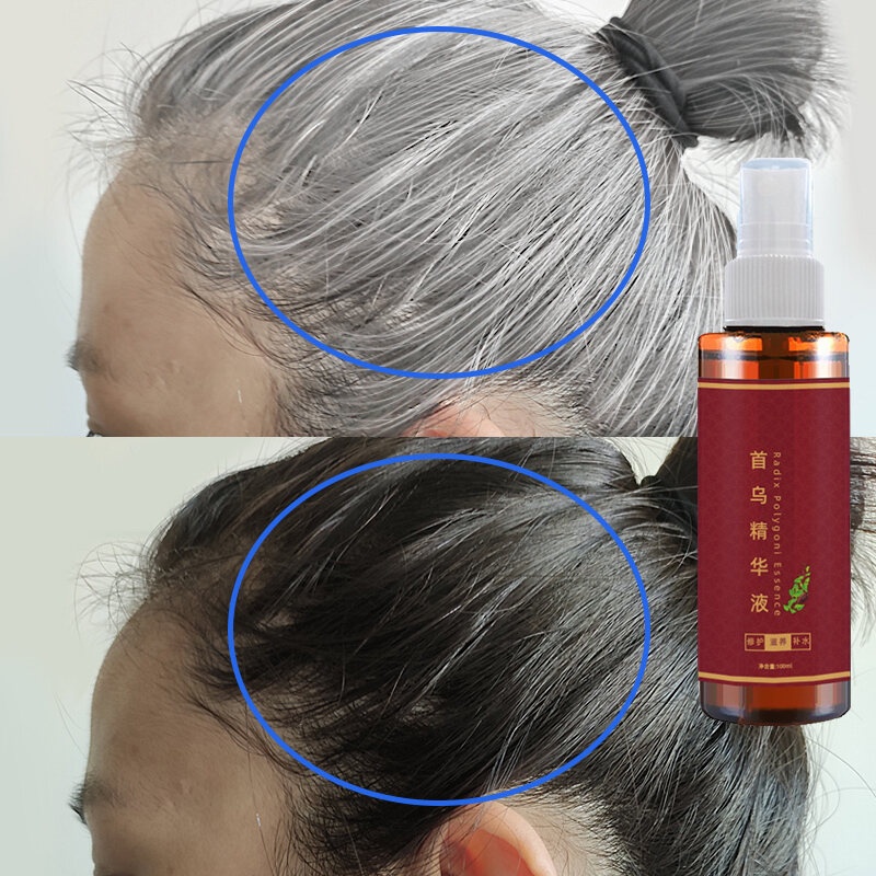 Pertumbuhan rambut Kondisioner fo-ti/Merawat rambut Serum Memperbaiki folikel rambut Cepat menumbuhkan rambut/Cairan jahe penumbuh rambut Rambut putih cepat menghitam Anti rambut rontok pria dan wanita