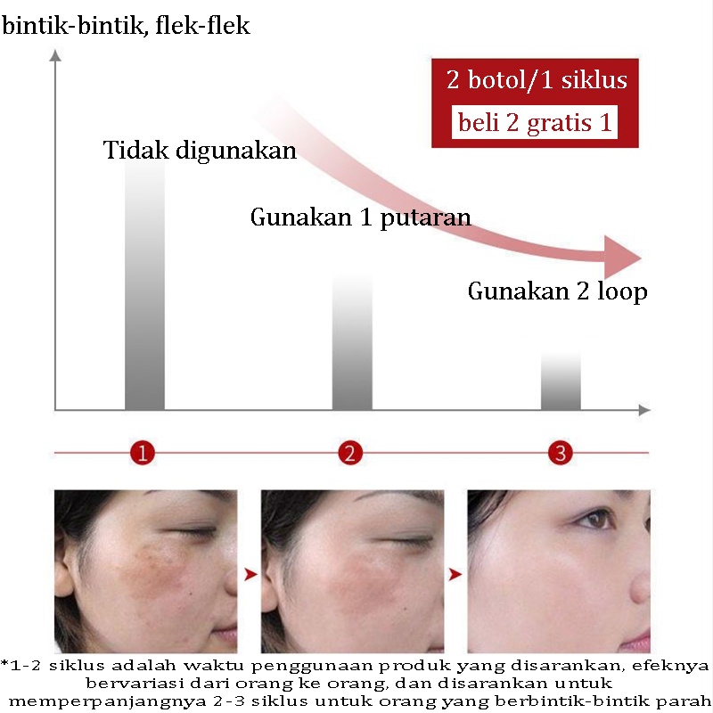 Krim pemutih Bintik Krim Pemutih Krim Pemutih wajah Krim Penghilang Melasma 30G