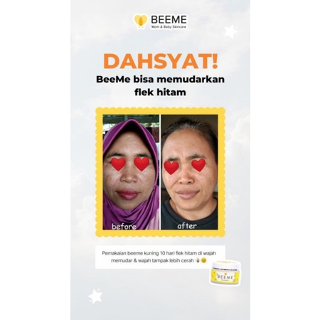 Paket Beeme Nourishing Balm 2pcs | SKINCARE IBU DAN ANAK [Free Gift]