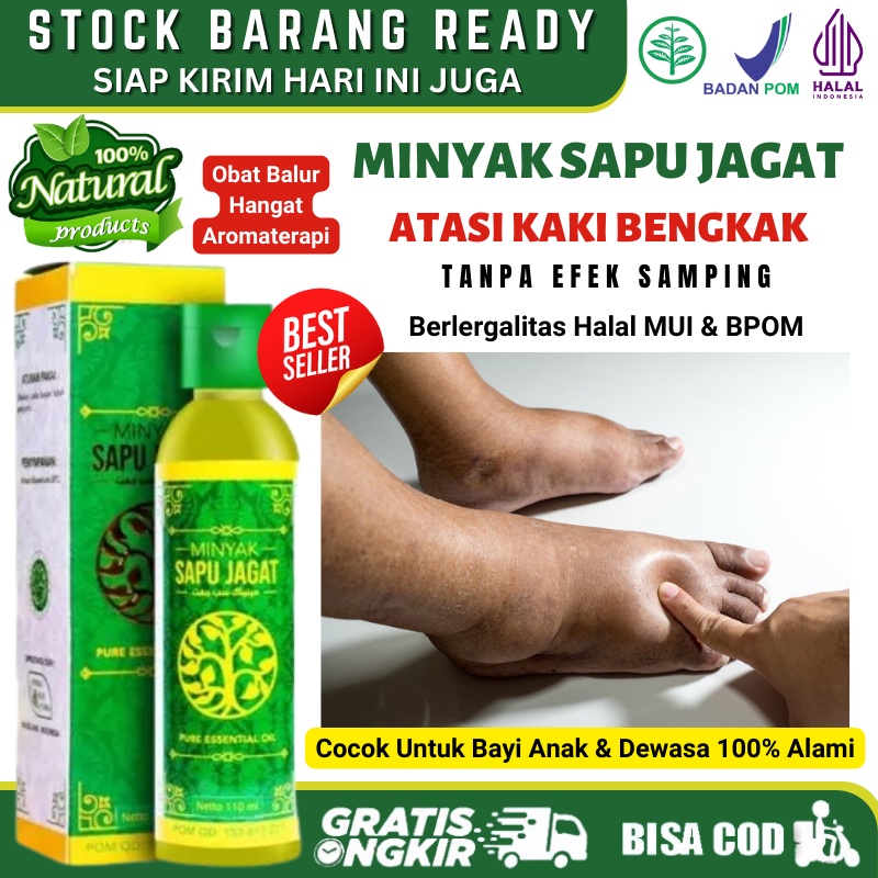 Obat Alami Kaki Bengkak Pada Bayi, Obat Balur Pengempis Kaki & Tangan Bengkak Pada Bayi, Obat Kaki B