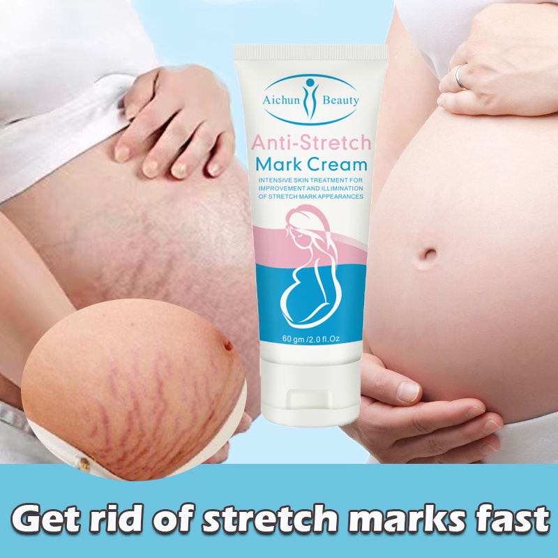 Stretchmark Stretch mark cream Krim stretch mark krim penghilang bekas luka 60ML Secara efektif menghilangkan stretch mark Menghilangkan stretch mark dengan cepat dalam seminggu Memudarkan bekas luka Onset cepat Tersedia untuk ibu hamil