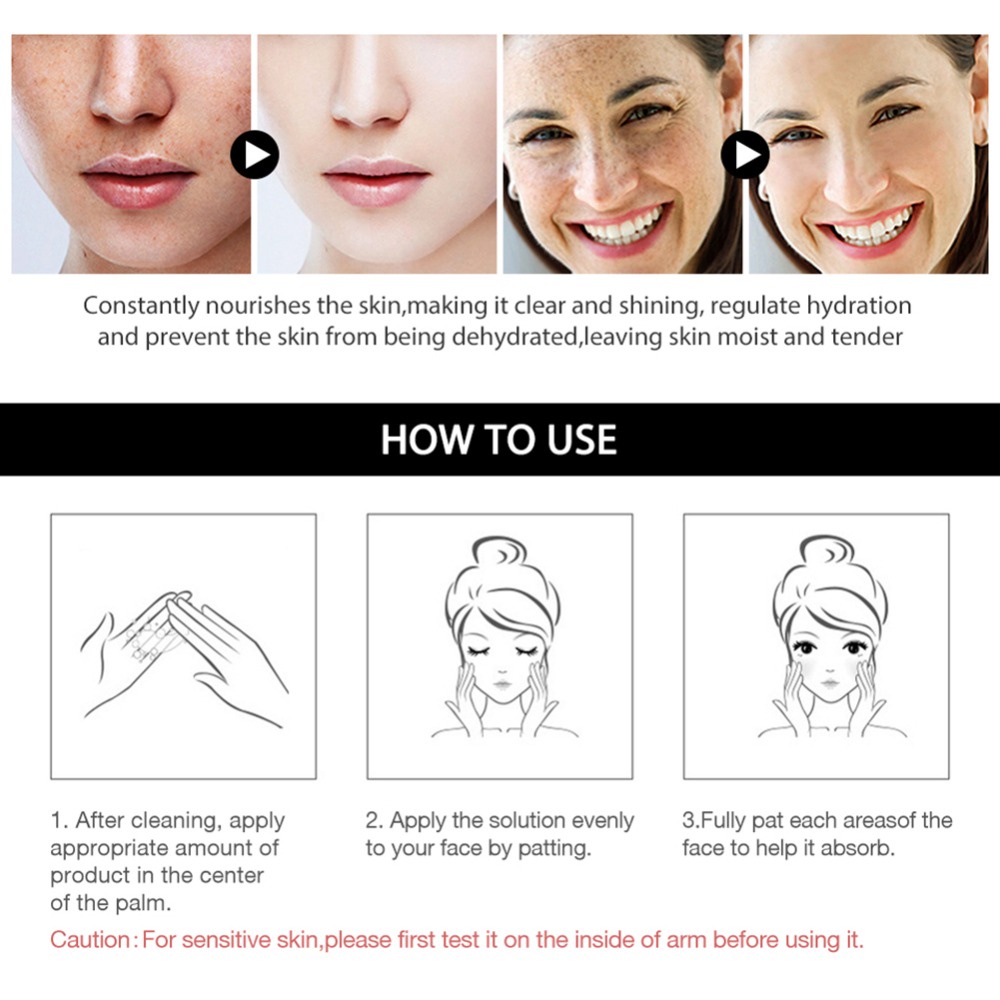 Penghilang flek hitam di wajah ampuh bpom menghilangkan bintik bintik di wajah Melasma Ampuh Remedy Black Spots tanpa melukai kulit Whitening Freckle