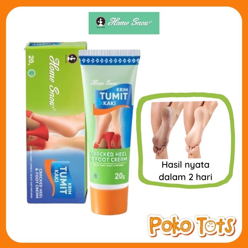 Home Snow Cracked Heel &amp; Foot Cream 20 &amp; 50 gr Krim Perawatan Kaki dan Tumit WHS