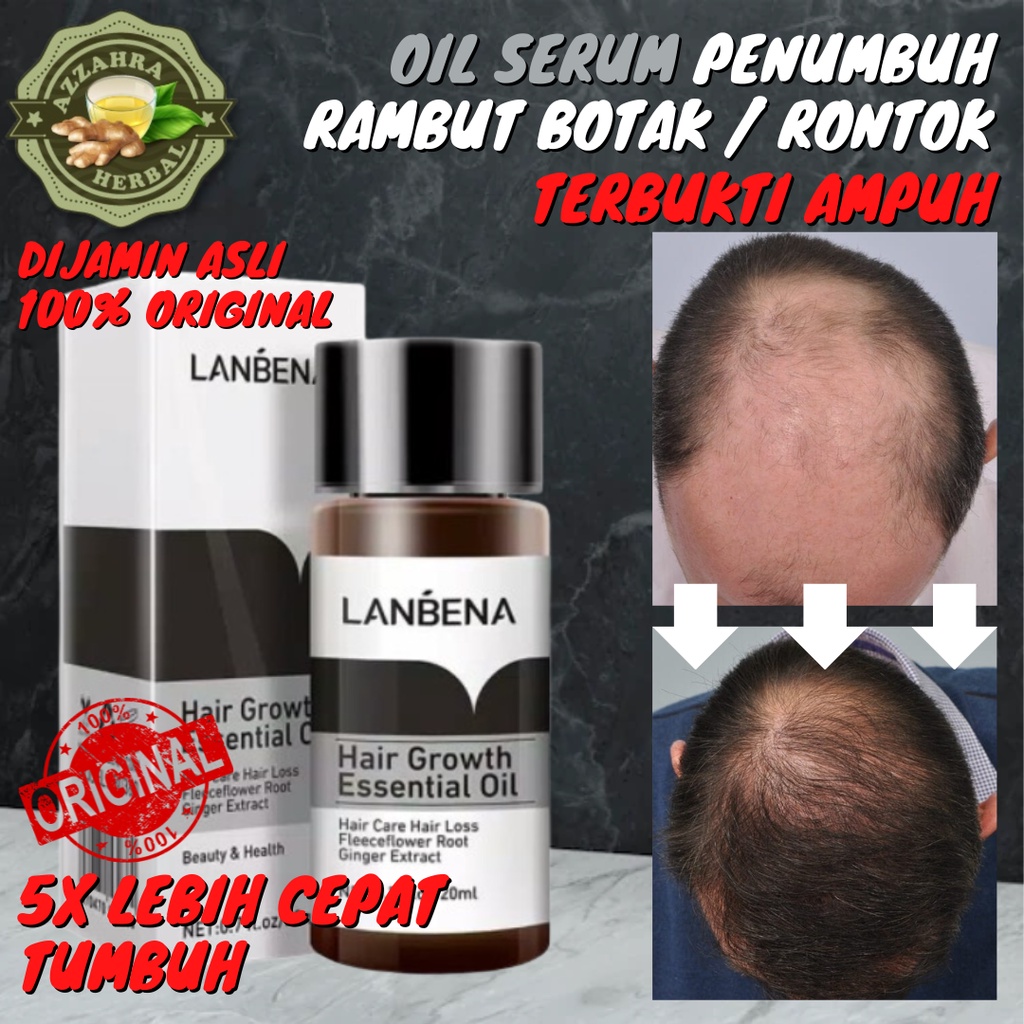 Penumbuh Rambut Botak Dan Rontok Pria Wanita Cepat Serum Essence Penghitam Uban Penyubur Original / LANBENA Hair Growth Oil