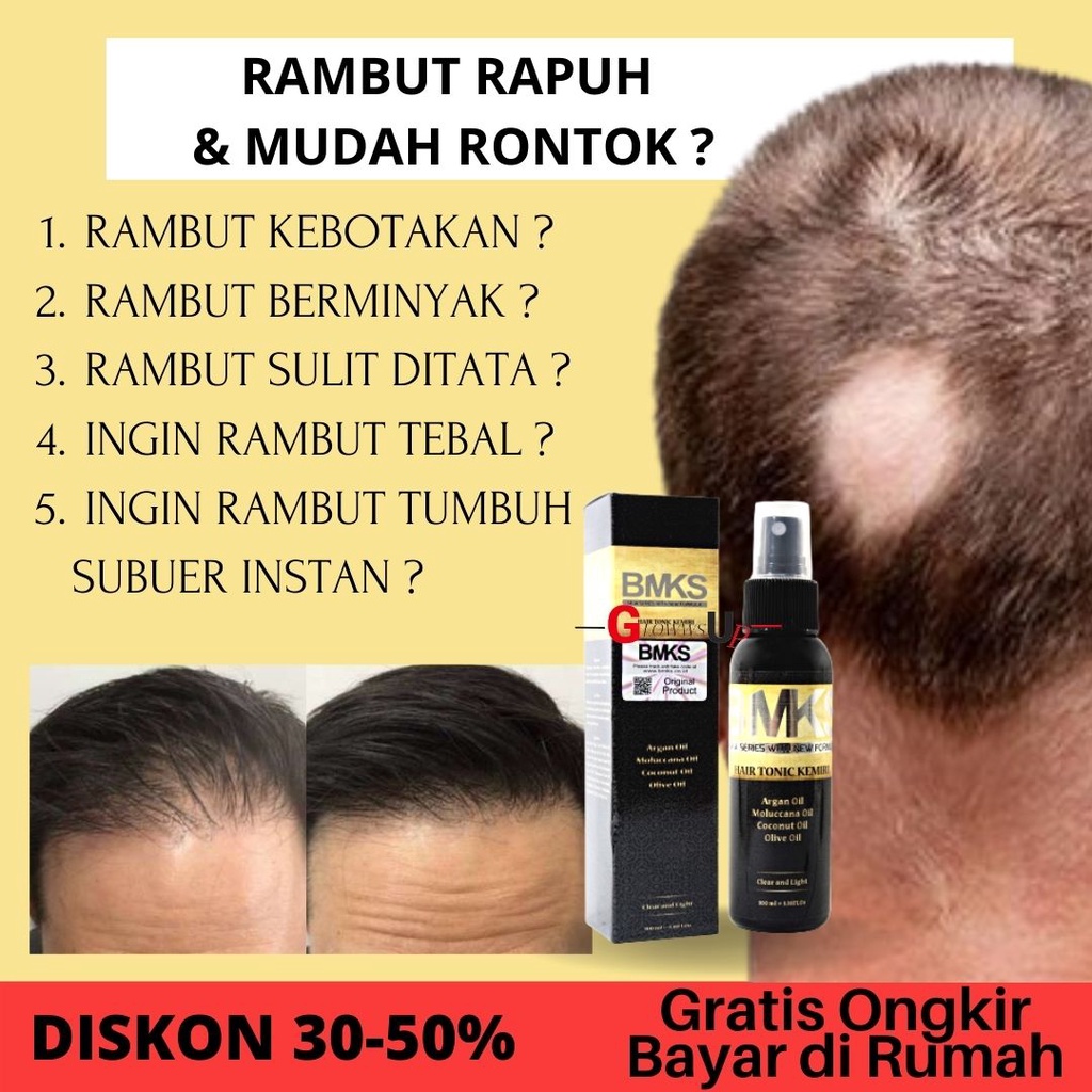 HAIR TONIC BMKS KEMIRI TREATMENT RAMBUT - PERAWATAN RAMBUT RONTOK - HAIRTONIC PENYUBUR RAMBUT