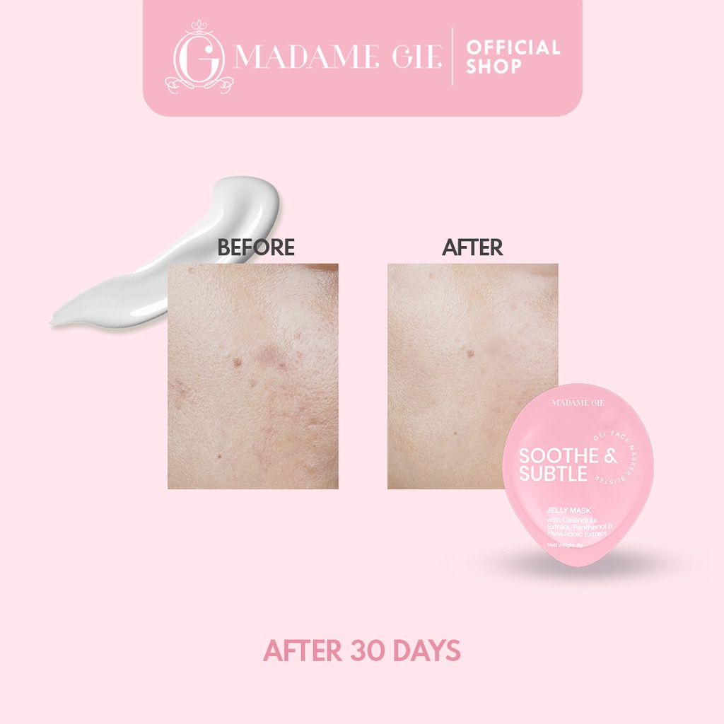 Madame Gie Jelly Mask | Masker Wajah | Glass Skin |  Soothe &amp; Subtle | Clarify