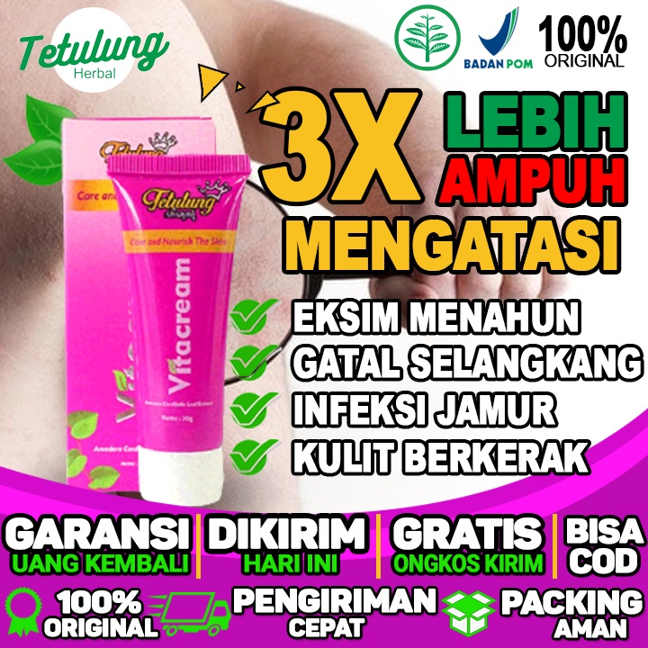 apa obat eksim kering tradisional obat eksim basah obat eksim yang bagus