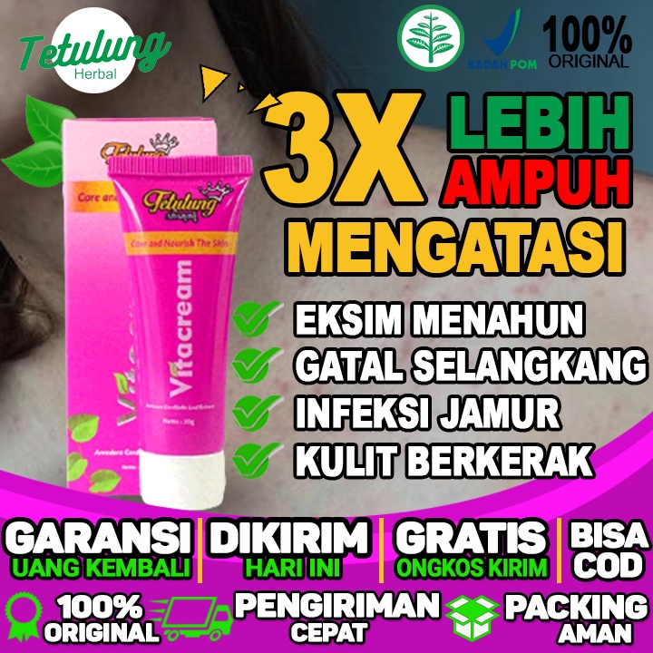 obat eksim kering alami obat eksim kepala obat eksim kaki obat eksim kering yang ampuh