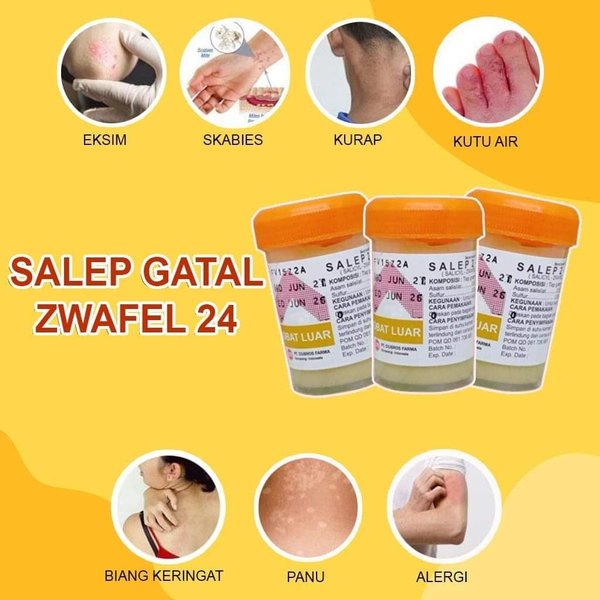 [Cod] Salep Cina Obat Gatal Panu Paling Ampuh Zwafel 24 Original Salap Obat Belerang Dan Obat Kurap 