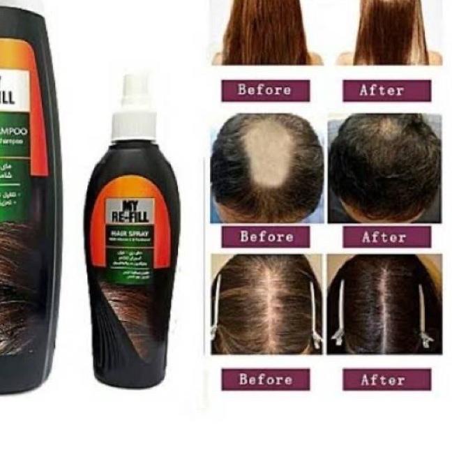 11.11✔️MyWay RE-FILL Perawatan & Penumbuh Rambut Rontok Botak | Jenggot | Anti Rontok Shampoo | Seru
