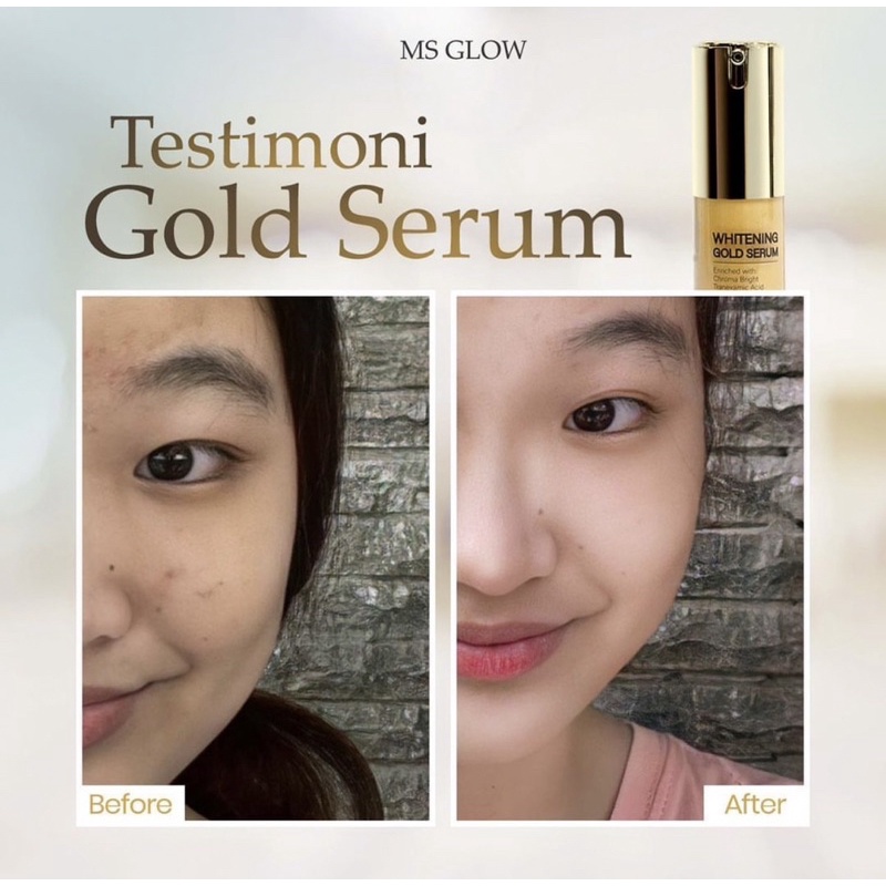 SERUM GOLD MSGLOW TERMURAH