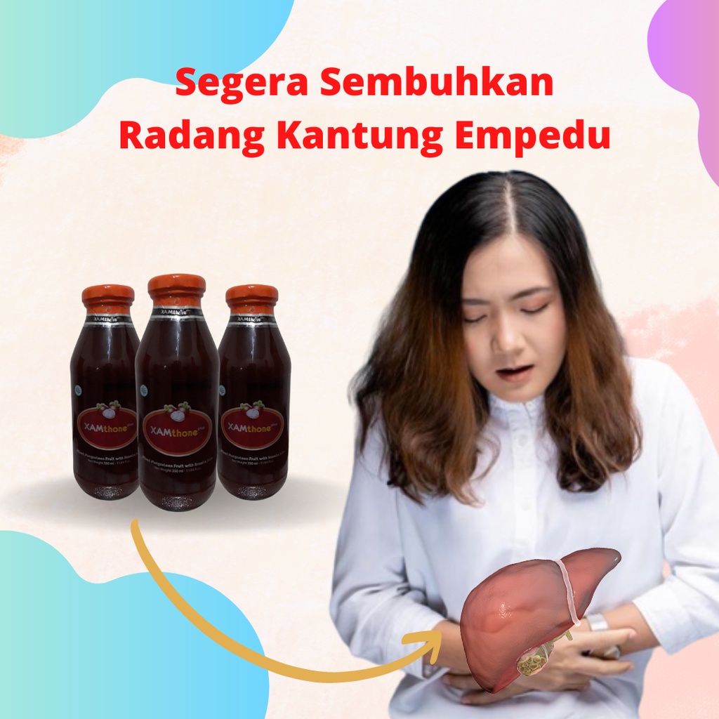 

Obat Peradangan Batu Empedu Terbukti Sembuh