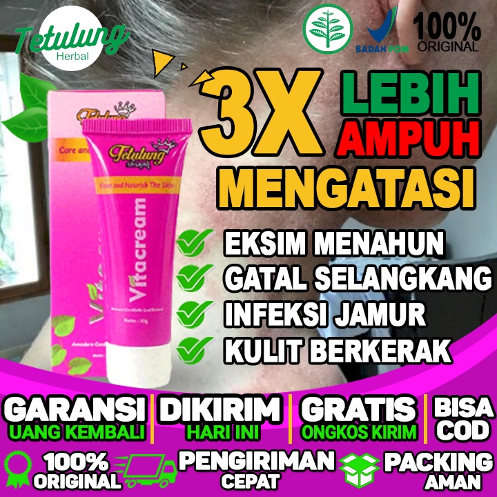 obat untuk gatal eksim obat eksim herbal eksim basah dan eksim kering