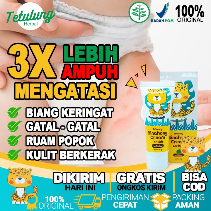 Jual Obat Jamur Ampuh Untuk Anak dan Bayi Kadas Kurap Biang Keringat Salep GatalTetulung