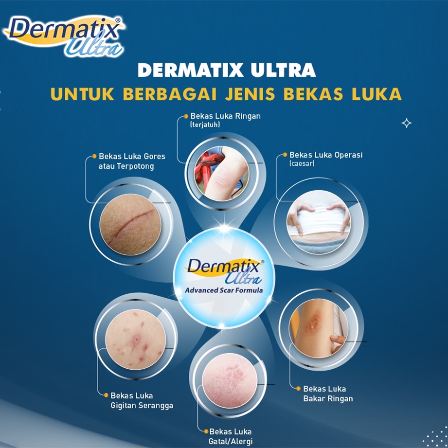 Dermatix Ultra Gel Advanced Scar Formula 15gr Salep Penghilang Bekas Luka/Dermatix Penghilang Bekas Luka/Scar Removal Cream