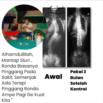 Korset Lumbal Tulang Belakang Alat Terapi Pinggang Wanita Dan Pria Untuk Sakit Pinggang Syaraf Kejepit Sabuk Pelurus Tulang Belakang Magnetik Batu Tourmaline Magnetic Original