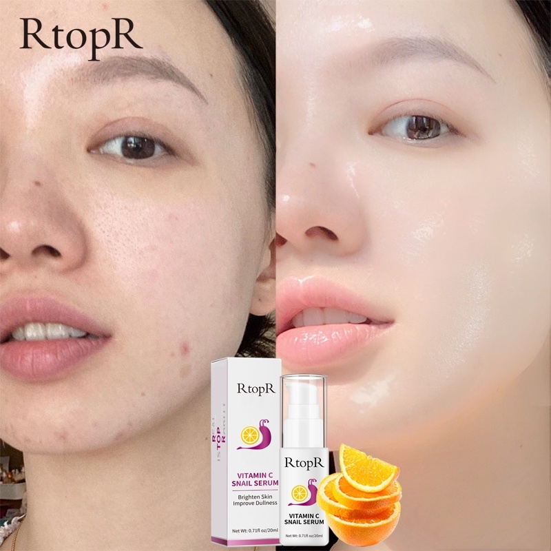 RtopR Vitamin C + Snail Serum Vitamin C Snail Serum Brightening Anti Aging And Skin Barrier Essence Face Dark Spot and Minimize Pore