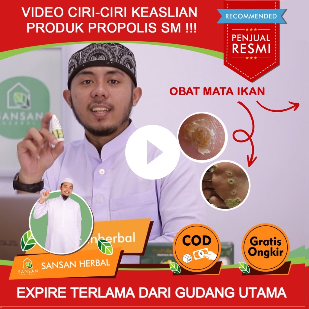 Jual Obat Mata Ikan Obat Mata Ikan Telapak Kaki Obat Mata Ikan Di Tangan Obat Mata Ikan Untuk