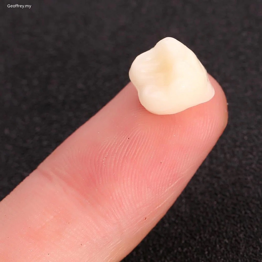 Gigi palsu resin akrilik acrylic CAIYU full set gigi tiruan gigi lepasan denture lab ALICE DENTAL