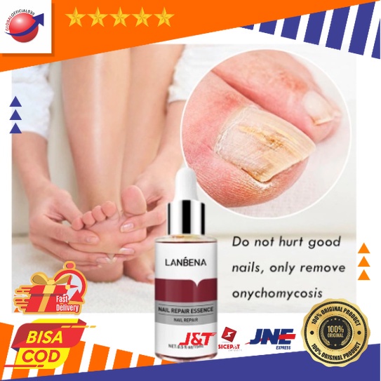 LANBENA Nail Repair Essence Serum Vitamin Perawatan Kuku Jamuran Manicure Pedicure COD