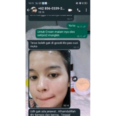 ZUBY GLOW WHITENING GLOWING AMPUH MEMUTIHKAN DLM 7HARI