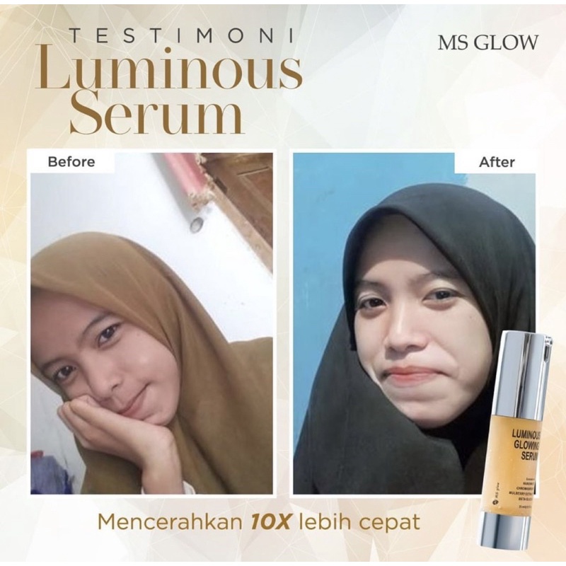 SERUM LUMINOUS MSGLOW TERAMPUH