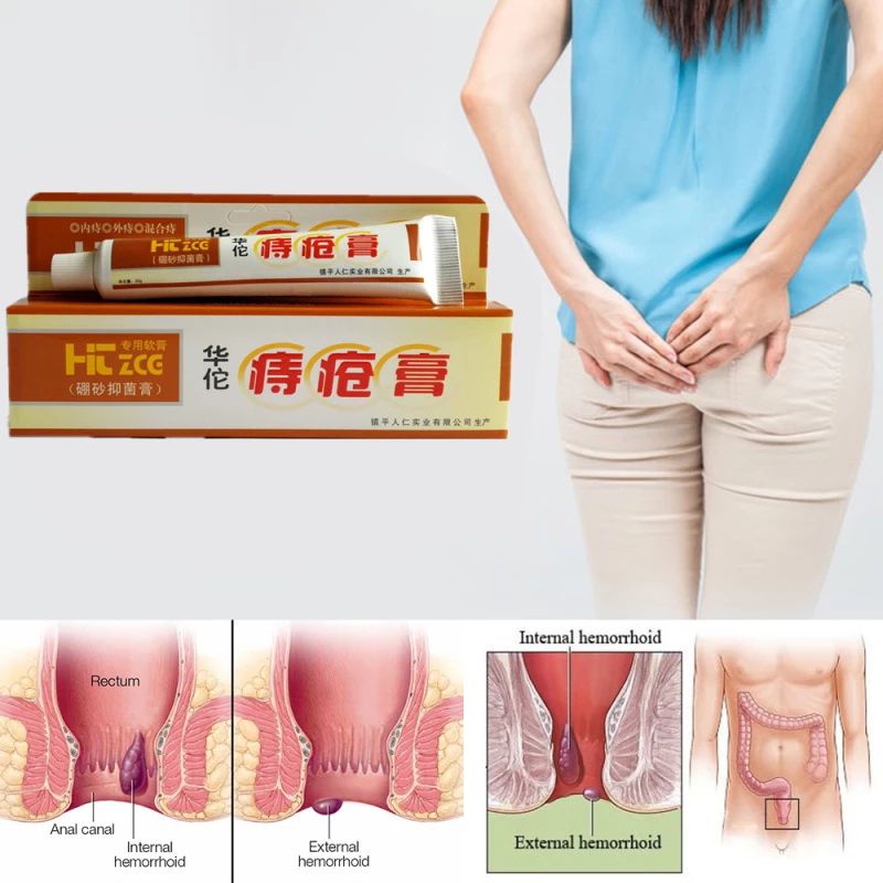 Huatuo Zhichuang Gao 100% ORIGINAL Obat Oles Luar Cream Krim Salep Wasir Ambien AMPUH AMAN TANPA EFEK SAMPING Krem Ambeyen Ambeien Ambian Hemorrhoids Salap Herbal Cina Asli Ambeien Sembelit Diare Akut Diktamani Dictamini Washir China OC18