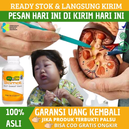 Obat Ginjal Bocor dan Bengkak, Obat Herbal Ginjal Bocor Sindrom Nefrotik, Kebocoran Ginjal, Urin Ber