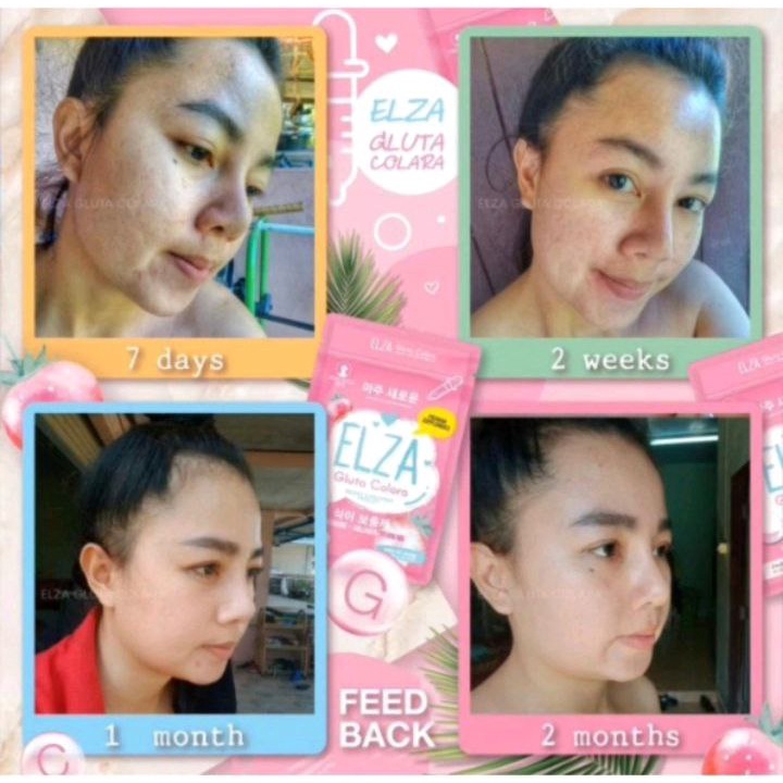 ELZA COLLAGEN GLUTA CORALA ISI 60 CAPSULE DIJAMIN ORIGINAL/SUPLEMEN/COLLAGEN BY PRECIOUS SKIN