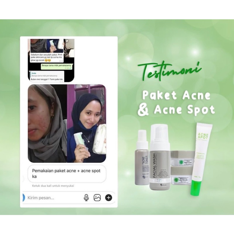 Ms Glow Paket Wajah Acne Original/whitening/luminous/ultimate