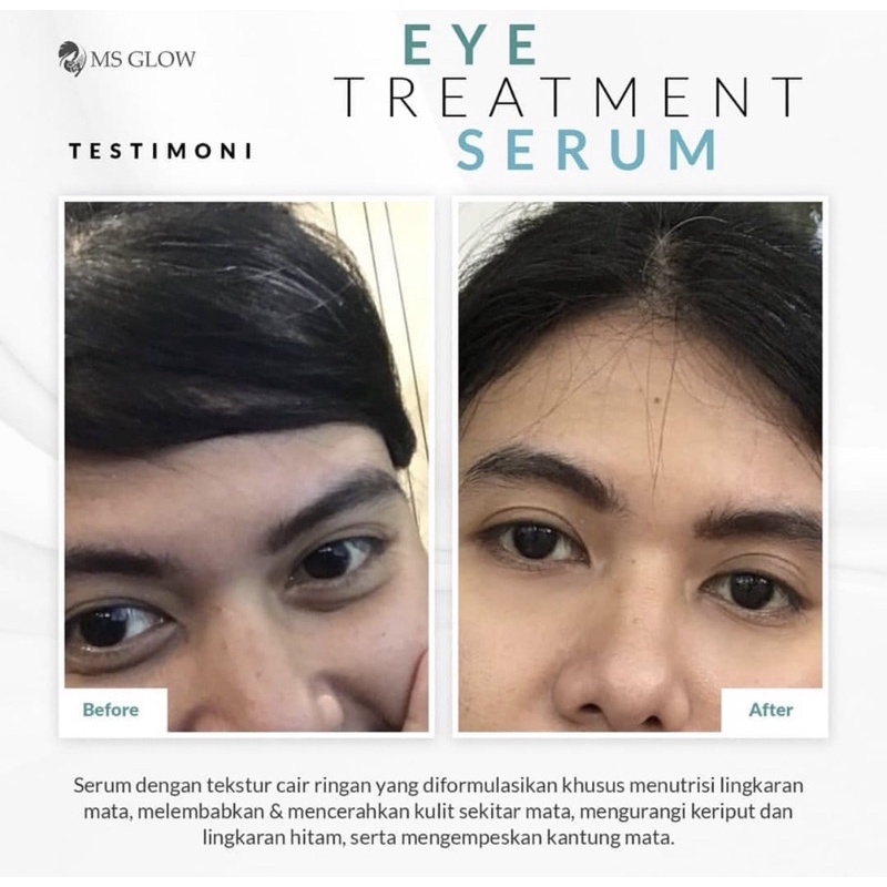 EYE SERUM MSGLOW EYETREATMENT SERUM