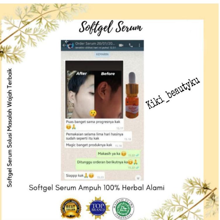 Laris✸➨ SOFTGEL SERUM Pemutih Wajah || penghilang flek hitam || serum wajah glowing Y87 ✱