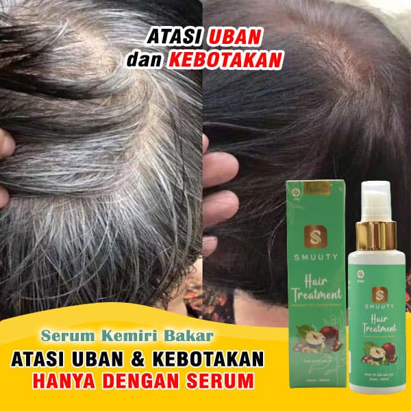 ( BISA COD ) Smuuty Hair Treatment Obat Penghilang Uban, Penghilang Uban Tanpa Semir - Memperbaiki R