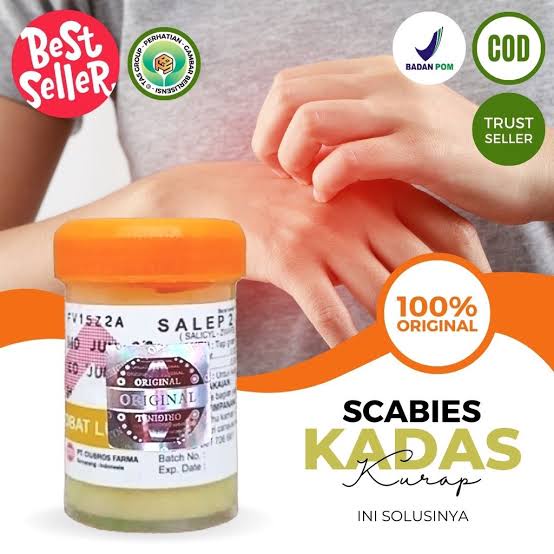 Salep Zwafel 24 Original Gatal Scabies | Obat Asli Gatel Panu Kadas Kurap kutu Air Selangkangan