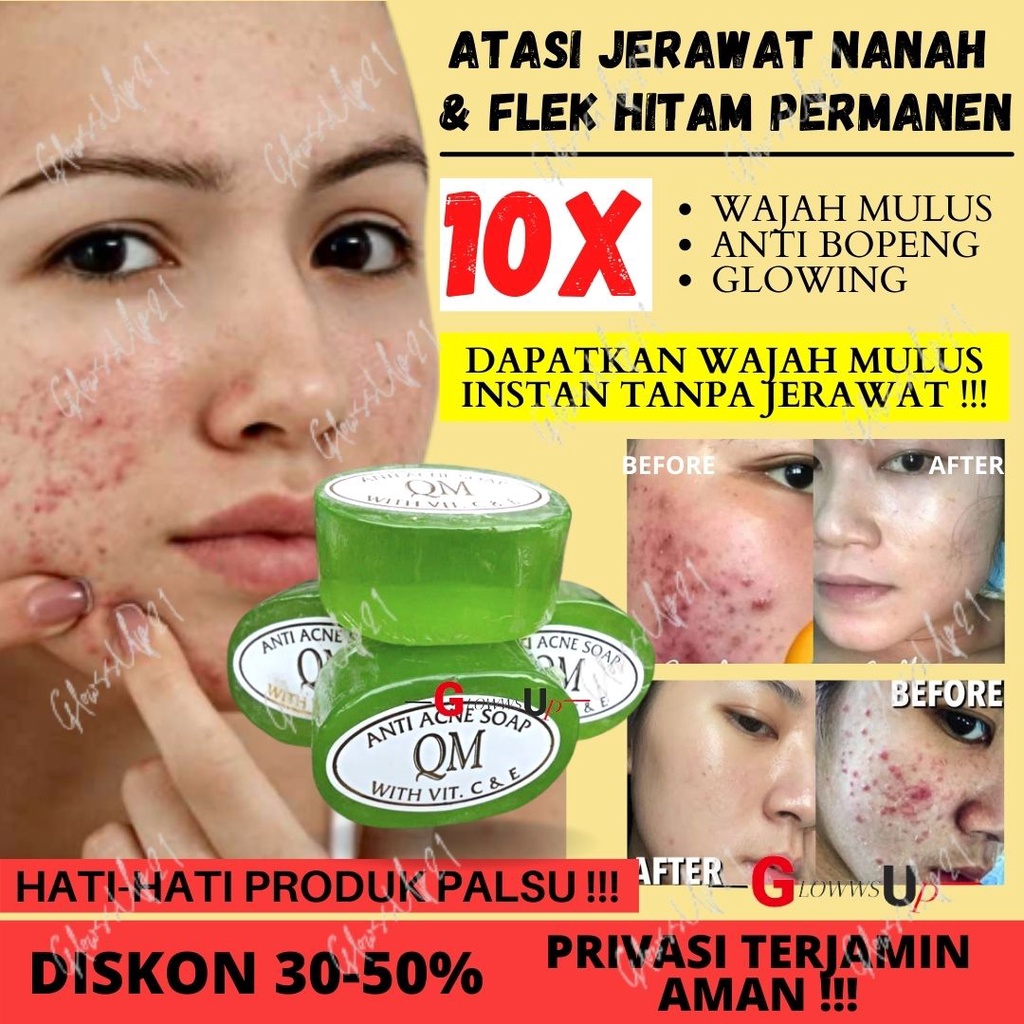 SABUN KHUSUS WAJAH DAN TUBUH BERJERAWAT QM FACIAL SOAP FOR ACNE SKIN BPOM - SABUN QM ANTI ACNE