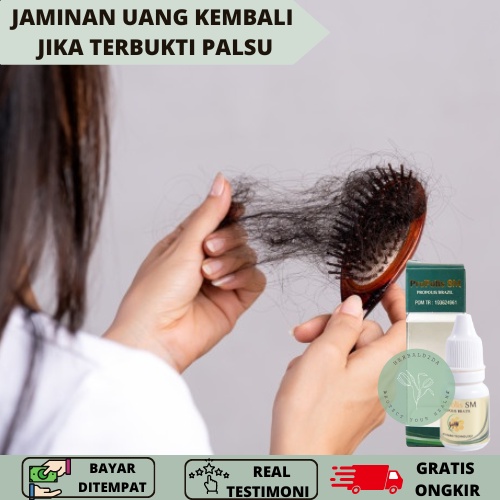 OBAT PENUMBUH RAMBUT BOTAK, Perawatan Rambut Rontok Rusak, Obat Rambut Rontok Parah, Obat Penumbuh P