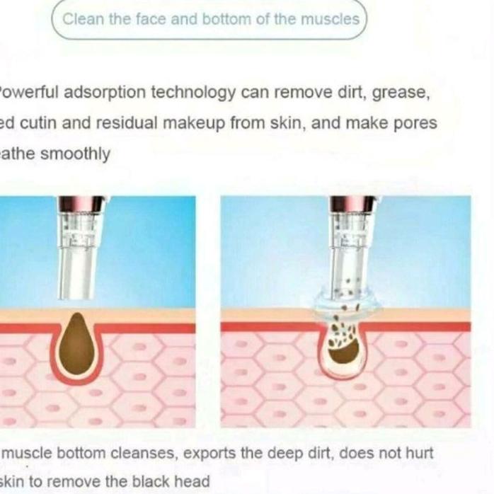 READY Alat Pembersih dan Penyedot Komedo / Alat Vakum Komedo / Alat Sedot Komedo / Blackhead Remover