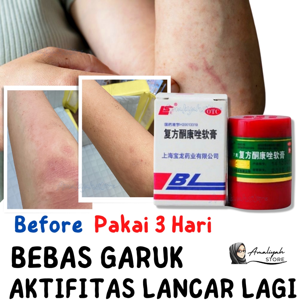 SALEP BL ORIGINAL 100% / SALEP PENGHILANG GATAL AMPUH / SALEP BL ORIGINAL PENGHILANG GATAL