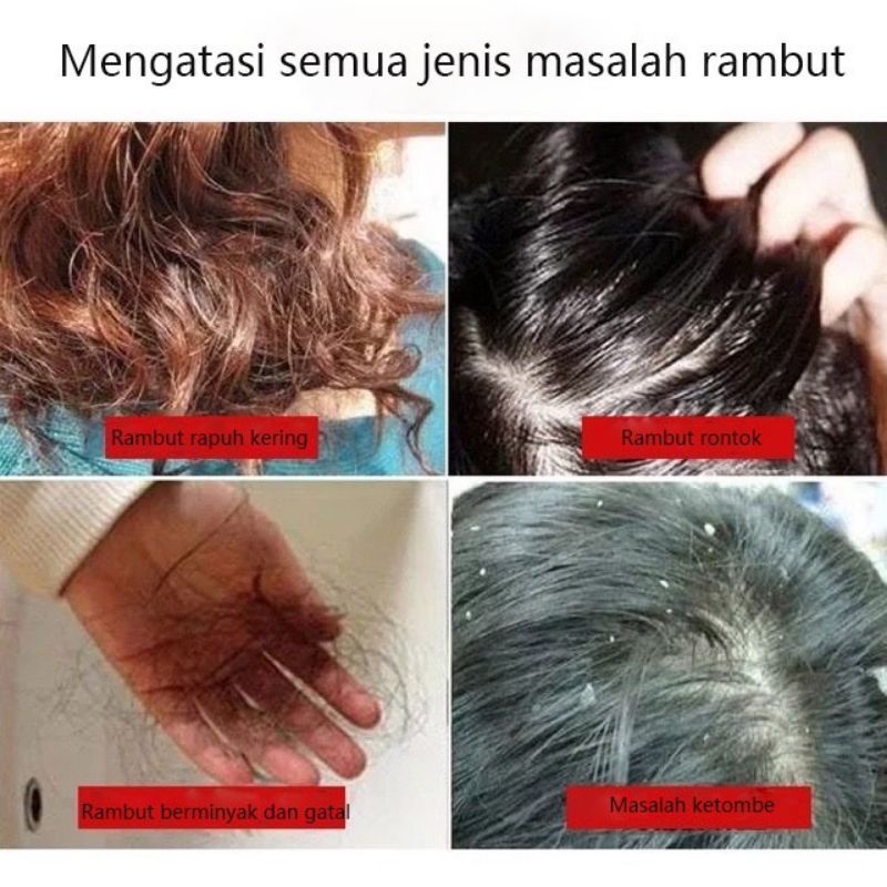 Zhenxiu Ginger Shampo Penumbuh Rambut / Sampo Jahe Anti Rontok Anti Ketombe Gatal / Cairan Essence Serum Jahe Ginger Serum Obat Vitamin Penumbuh Rambut